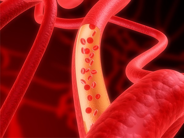 Chitosan hilft, Blutfett zu bilden Buch unterstützt, um den Cholesterinspiegel im Körper zu verbessern.